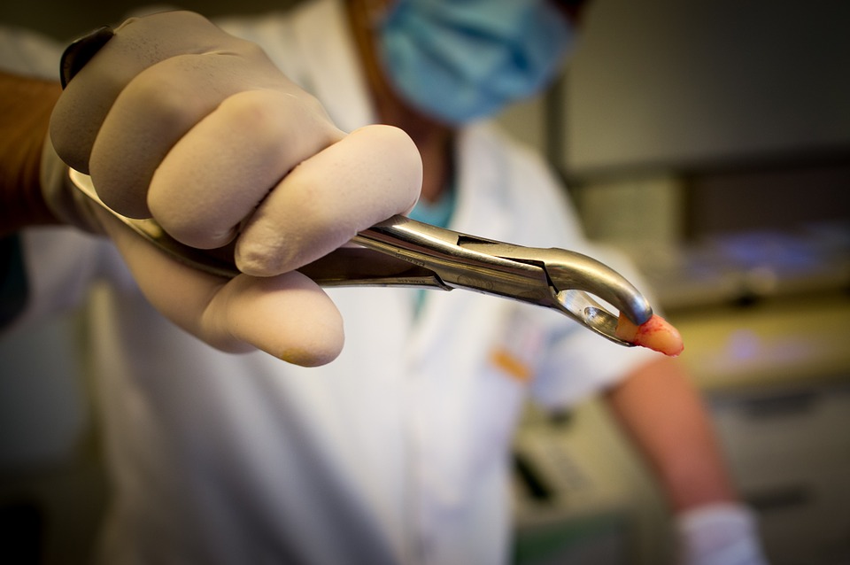 dentist pulling a tooth