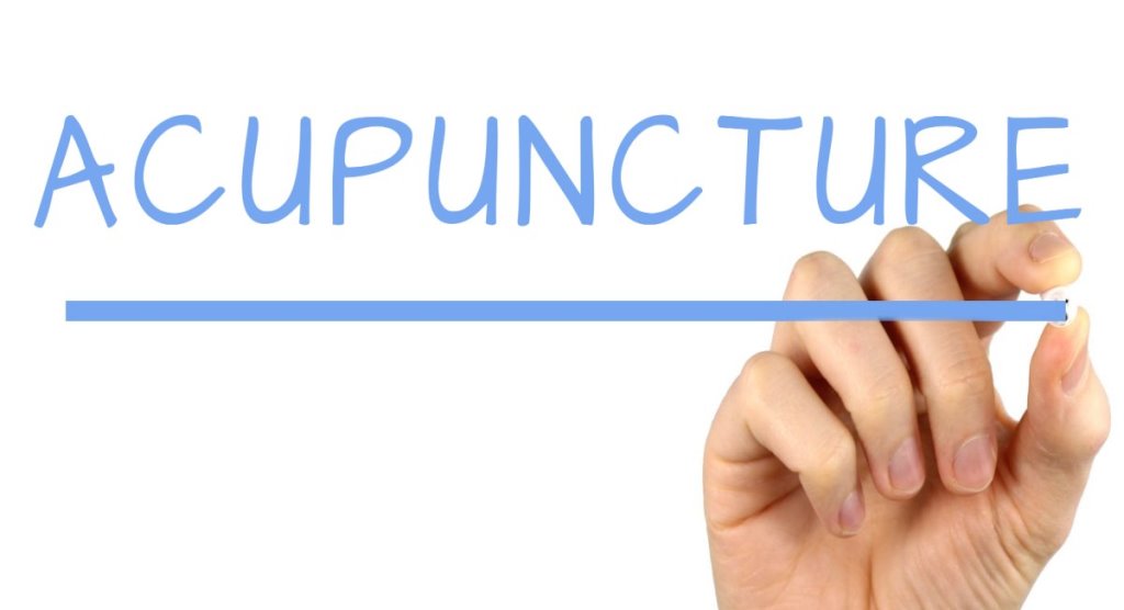 acupuncture treatment