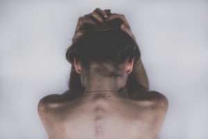 scoliosis